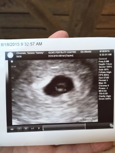 6wk_ultrasound