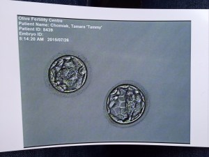 embryos_july7_2015