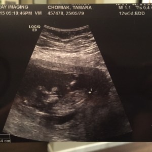 13wk_ultrasound